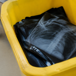 Radiographies empilees dans conteneur jaune de tri medical
