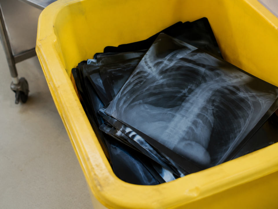 Radiographies empilees dans conteneur jaune de tri medical